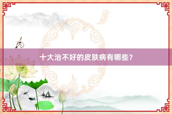 十大治不好的皮肤病有哪些？